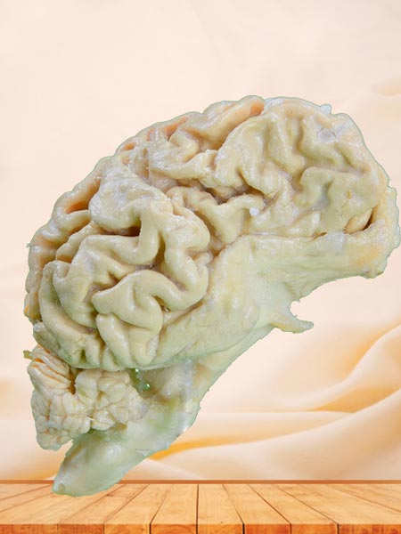The brain hemisphere of dog plastinated anatomical specimen