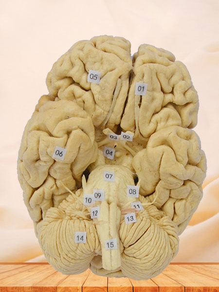 Whole Brain plastinated specimen