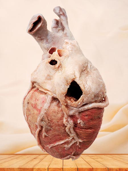 Whole heart plastinated specimen