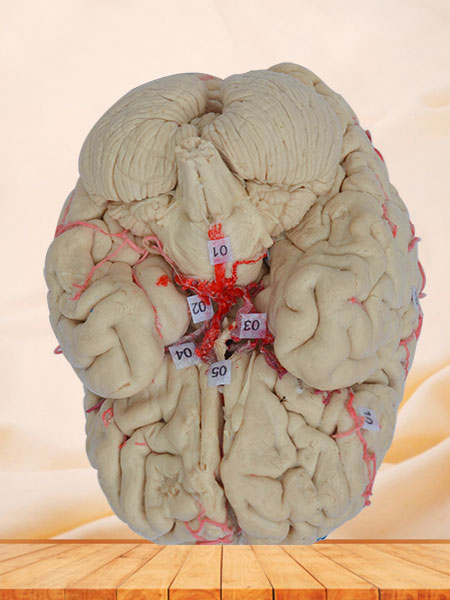 Artery of whole brain plastinated specimen