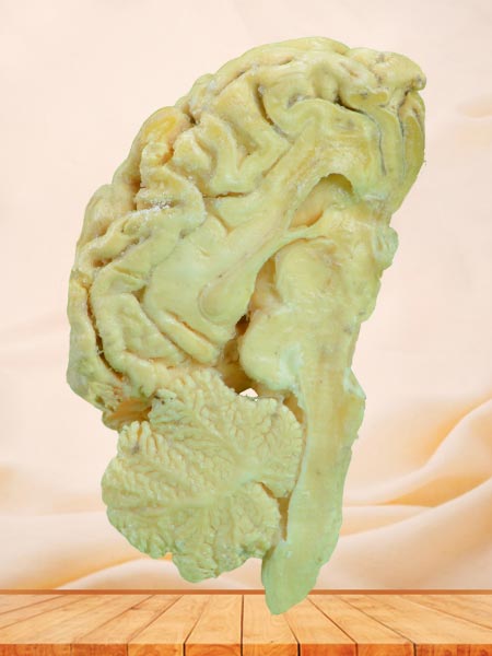 brain hemisphere of sheep plastinated specimen
