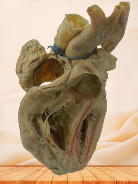 cardiac conduction system anatomy specimen