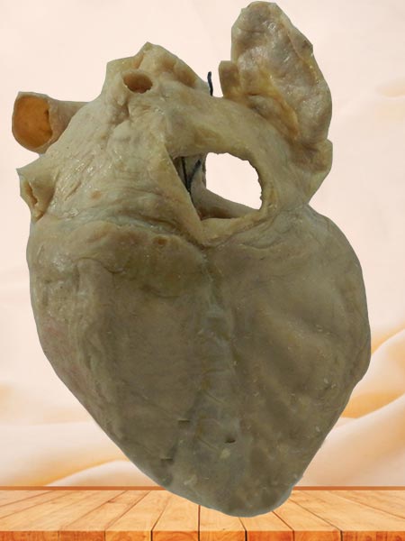 cardiac conduction system human specimen