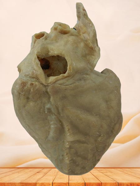 cardiac conduction system specimen