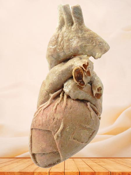 cardiac muscle specimen