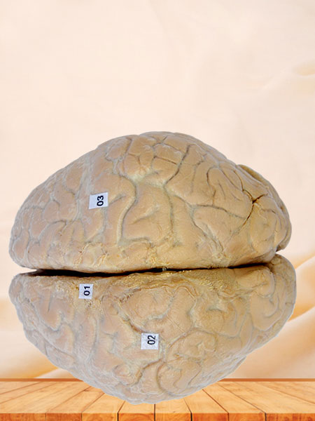 Cerebral arachnoid mater plastinated specimen