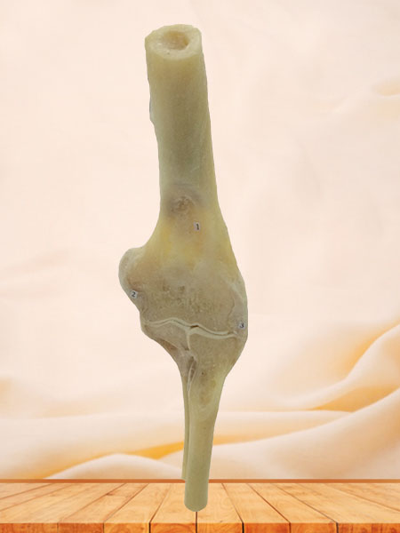 coronal section of elbow joint