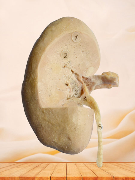 coronal section of kidney 3 quaters human plastination