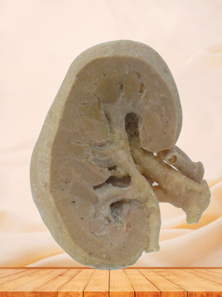coronal section of kidney human body plastination