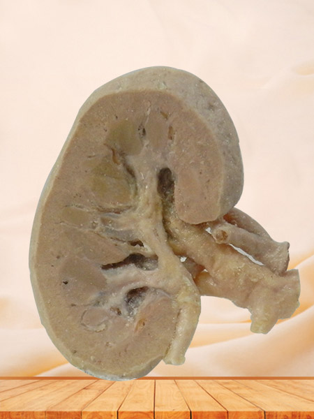 coronal section of kidney plastinated specimen