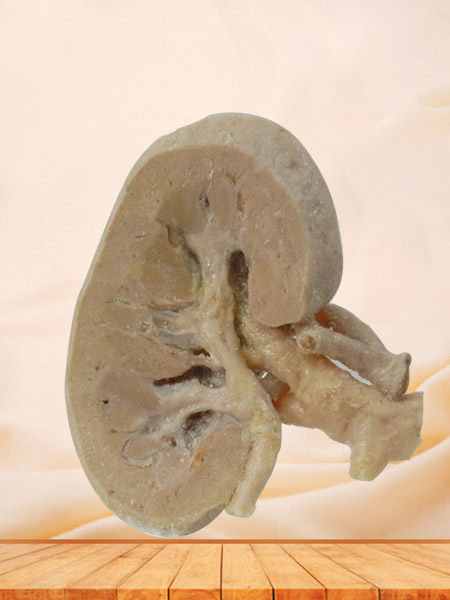 coronal section of kidney plastination specimen