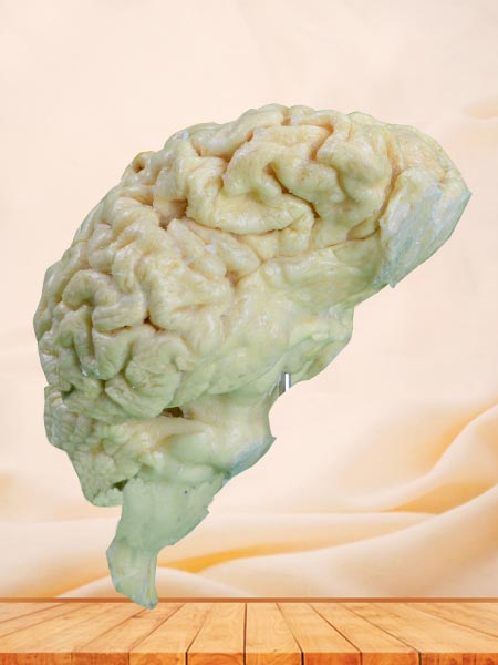medical brain of sheep plastination