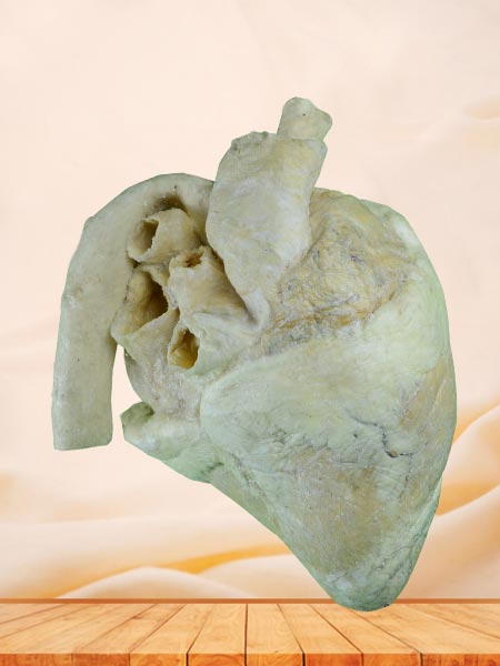medical heart of cow plastination