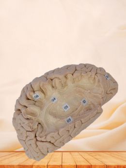 Human association fiber of cerebral hemisphere plastinated specimen