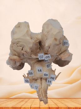 Brain stem with complete nerve root plastinated specimen