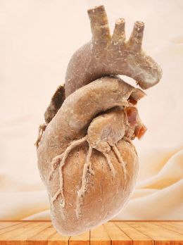 Blood vessels of heart plastinated specimen