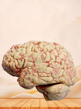 Cerebral hemisphere and brain stem plastinated specimen
