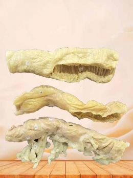 Comparison of ileum colon colon plastinated specimen