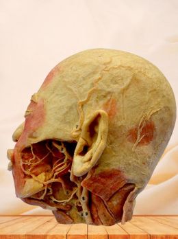 External carotid artery plastinated specimen