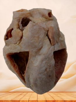 Heart plastinated specimen with ventricles opened to expose the valves