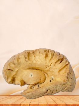 Hippocampal formation plastinated specimen