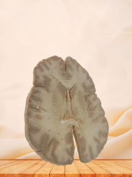 Horizontal section of brain through inner capsule plastinated specimen