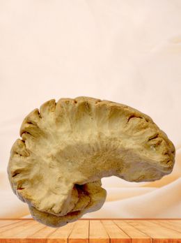 Insular lobe plastinated specimen