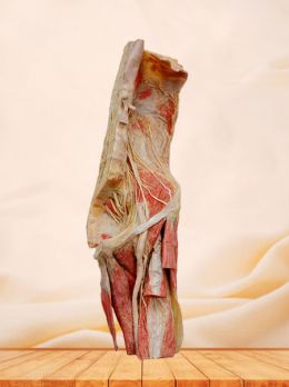 Lumbosacral plexus in situ plastinated specimen