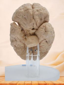 Paracele plastinated specimen