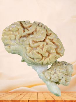 Pig brain hemisphere plastinated specimen
