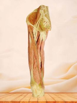 Superficial muscles of thigh plastinated specimen