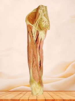 Superficial muscles of thigh plastinated specimen