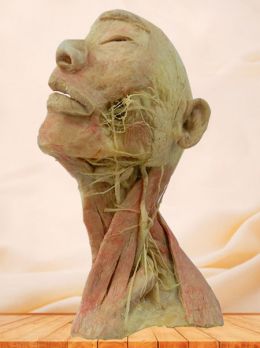 Superficial vascular nerve of head and neck plastinated specimen