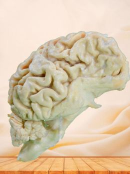 The brain hemisphere of dog plastinated specimen