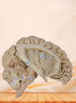 Tractus pyramidalis and cerebellar peduncle plastinated specimen