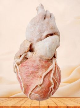 Whole heart plastinated specimen