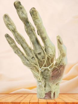 Deep arteries of hand plastinated specimen