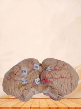 Artery of cerebellum plastinated specimen