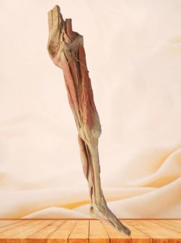 Artery of lower limb plastinated specimen