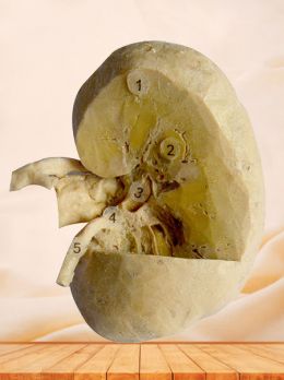 Coronal section of kidney 3 quaters plastinated specimen