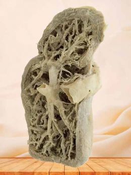 Liver segment plastinated specimen