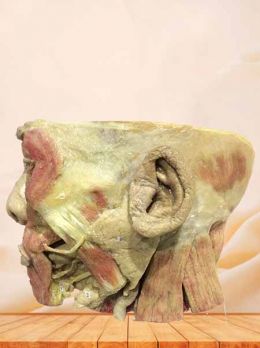 Salivary gland plastinated specimen