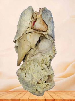 Human viscera plastinated specimen