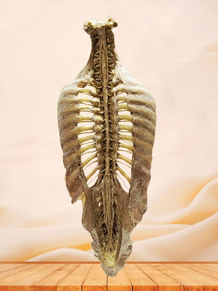 vertebral column plastinated specimen