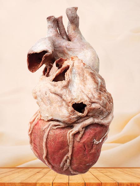 whole heart plastination specimen