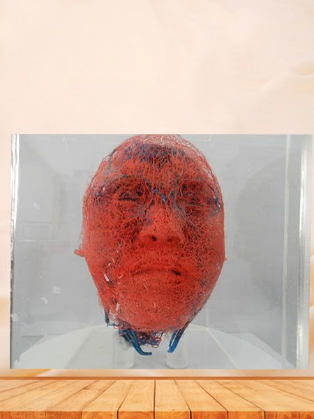 medical blood vessels of head and neck casting specimen