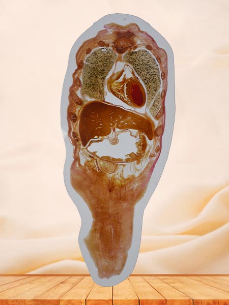 medical coronal section of whole body embedded specimen