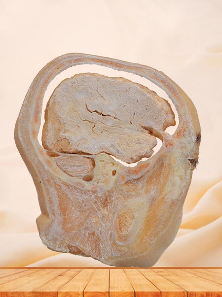 sagittal section of head plastinated specimen