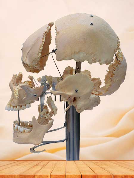 separated human skull plastination with teeth