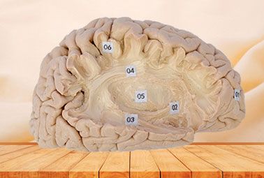 Association fiber of cerebral hemisphere plastinated specimen